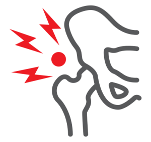 Heupklachten en Heuppijn |Oorzaken, behandelingen en adviezen